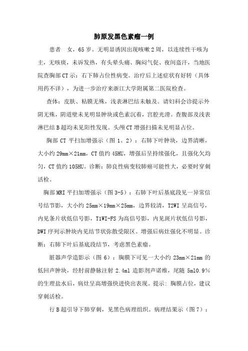 肺原发黑色素瘤一例