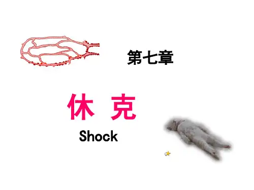 病理生理学——休克