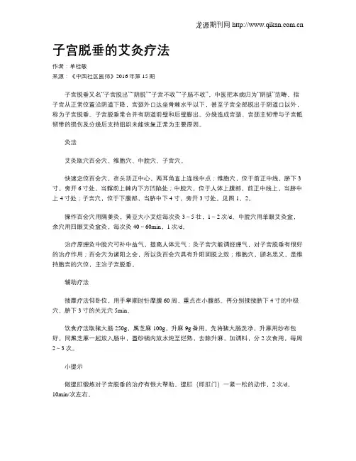 子宫脱垂的艾灸疗法