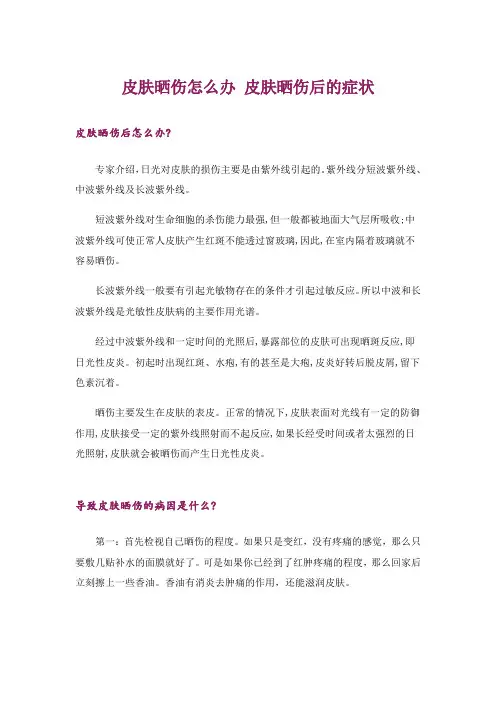 皮肤晒伤怎么办 皮肤晒伤后的症状