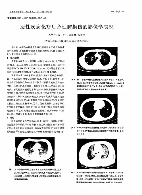 恶性疾病化疗后急性肺损伤的影像学表现