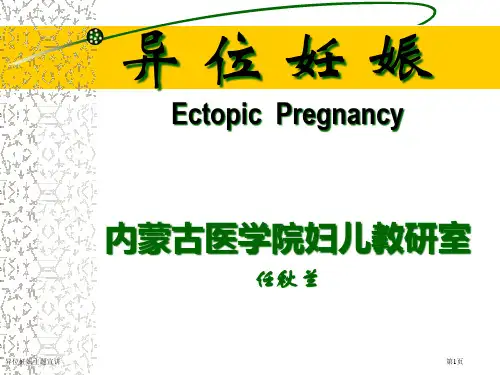 异位妊娠主题宣讲专家讲座