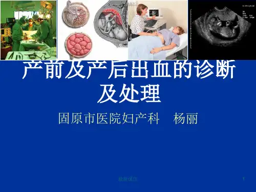 产前及产后出血的诊断及处理PPT课件