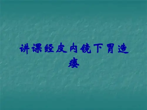 讲课经皮内镜下胃造瘘