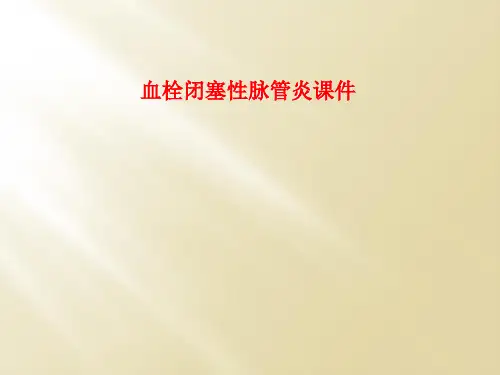 血栓闭塞性脉管炎课件