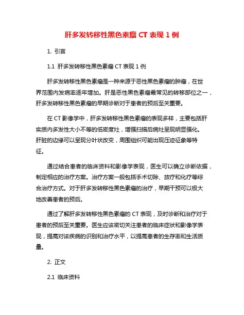 肝多发转移性黑色素瘤CT表现1例