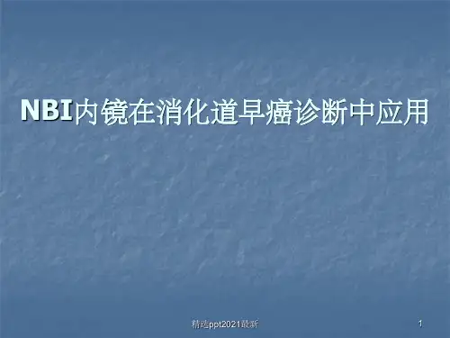 NBI内镜在消化道早癌诊断中应用课件PPT课件