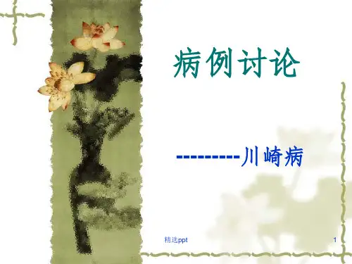 川崎病病案分析