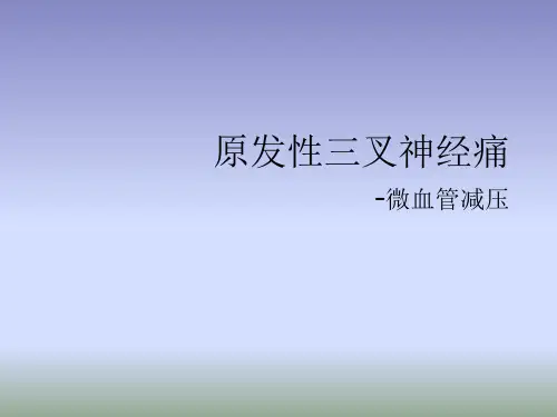 原发性三叉神经痛-微血管减压