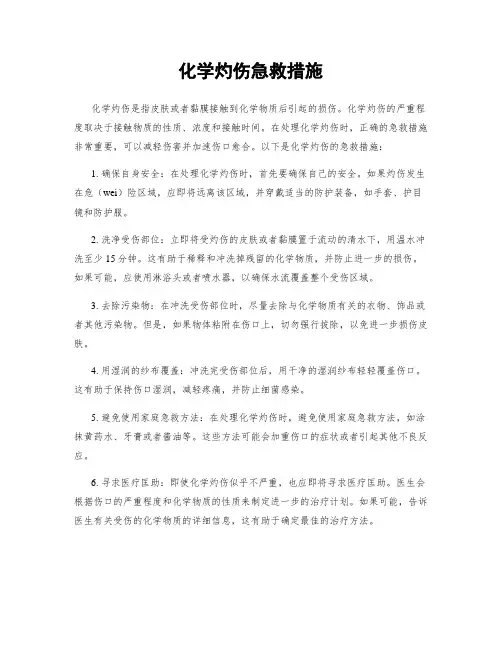 化学灼伤急救措施
