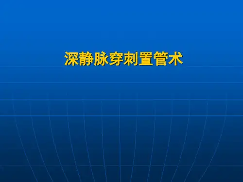 5深静脉穿刺置管术