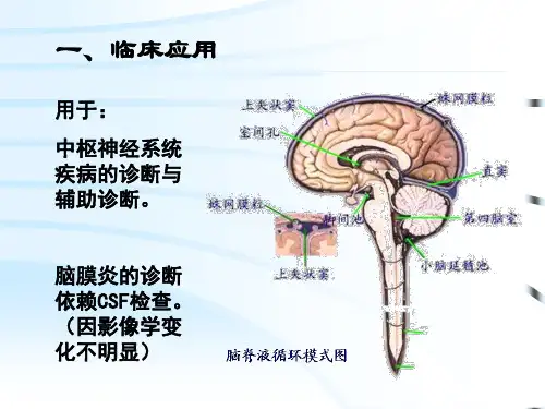 CSF脑脊液检查