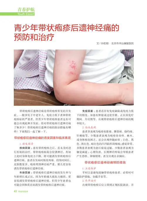 青少年带状疱疹后遗神经痛的预防和治疗