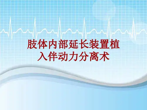 手术讲解模板：肢体内部延长装置植入伴动力分离术