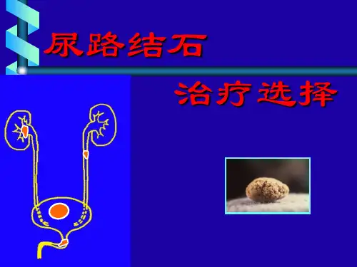 《尿路结石lu》幻灯片PPT