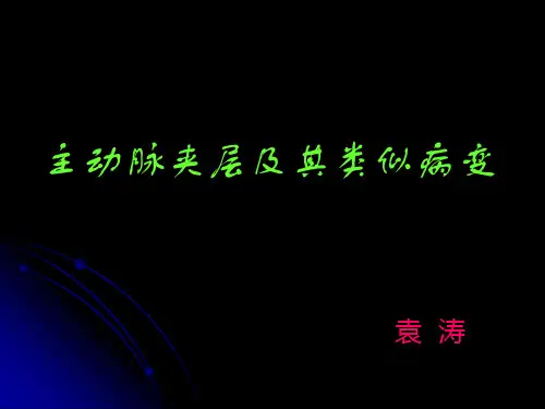 主动脉夹层的影像学表现