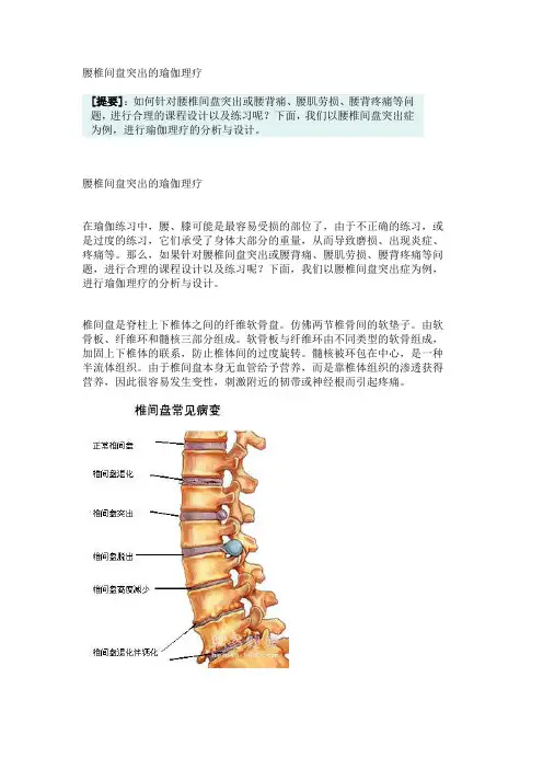 腰椎间盘突出的瑜伽理疗