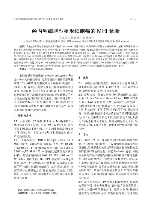颅内毛细胞型星形细胞瘤的MRI诊断