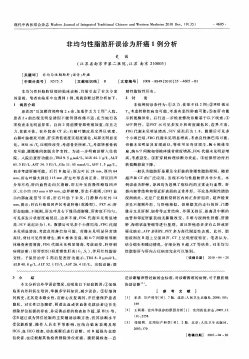 非均匀性脂肪肝误诊为肝癌1例分析