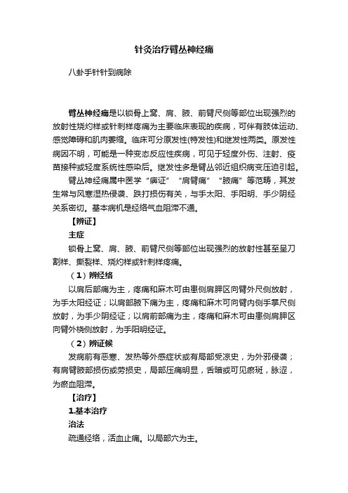 针灸治疗臂丛神经痛