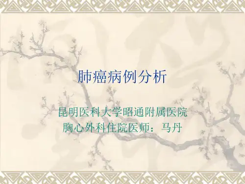 肺癌病例分析PPT课件