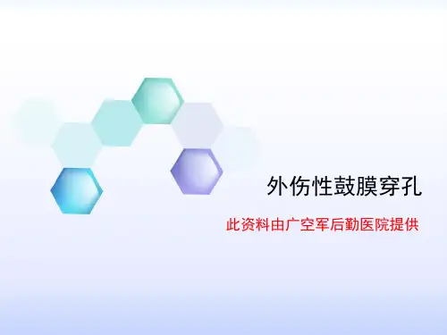 外伤性鼓膜穿孔
