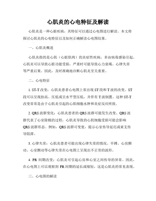 心肌炎的心电特征及解读