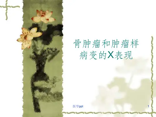 骨肿瘤和肿瘤样病变的X线表现