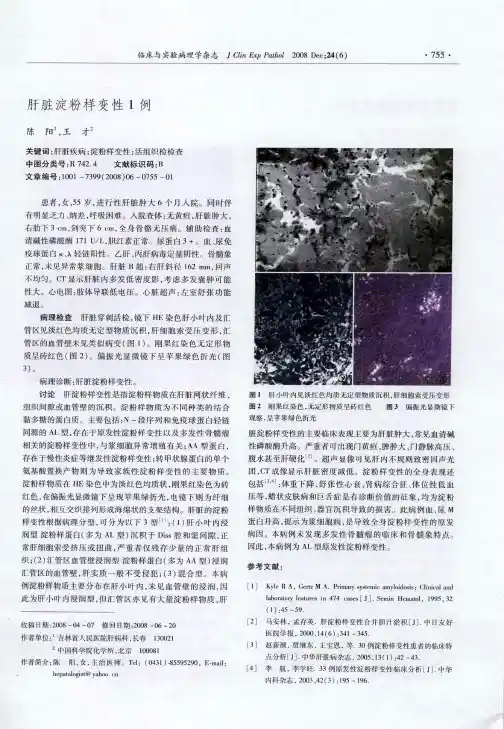 肝脏淀粉样变性1例
