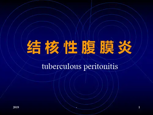 结核性腹膜炎摘要ppt课件
