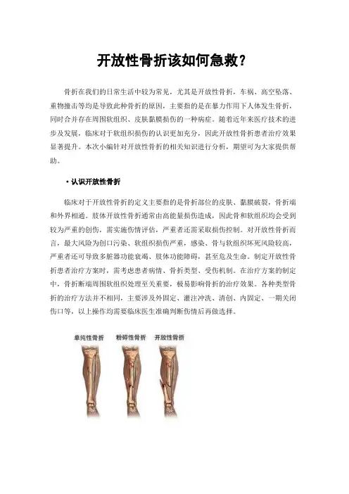 开放性骨折该如何急救？