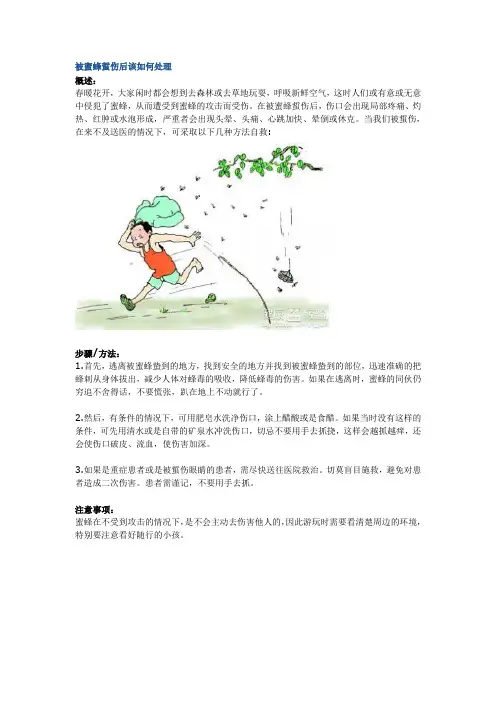 被蜜蜂蜇伤后该如何处理