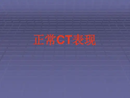 正常胸肺部影像学ppt课件