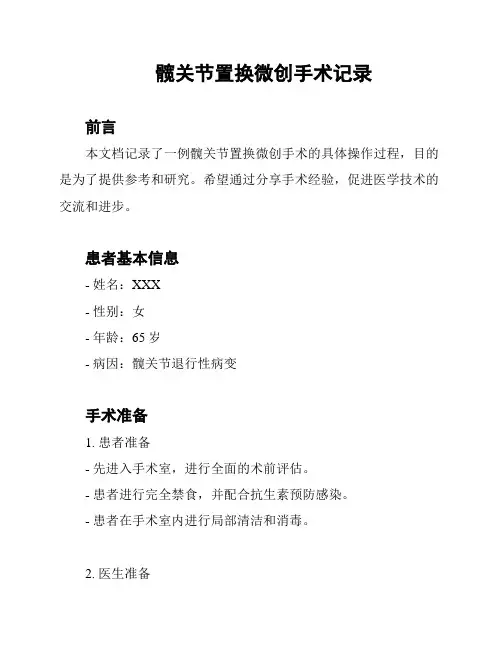 髋关节置换微创手术记录