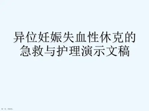 异位妊娠失血性休克的急救与护理演示文稿