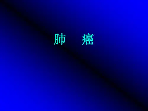 (完整版)肺癌ppt课件
