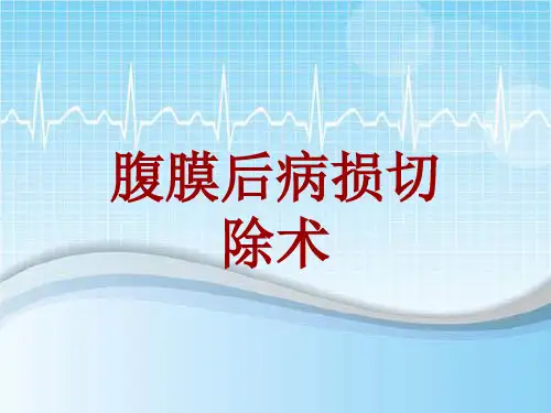 手术讲解模板：腹膜后病损切除术