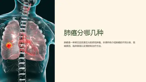 《肺癌分哪几种》课件