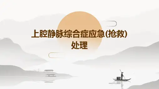 上腔静脉综合症应急(抢救)处理
