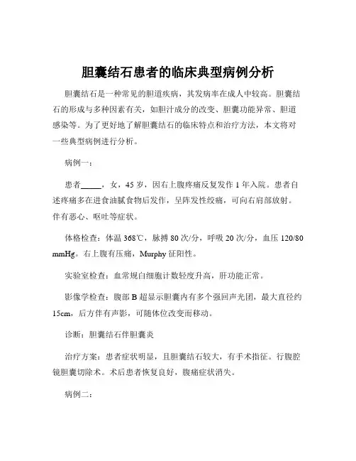 胆囊结石患者的临床典型病例分析