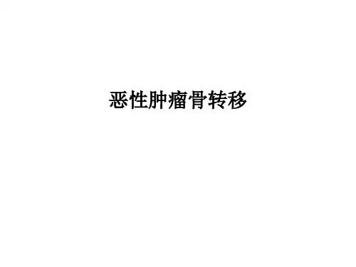 恶性肿瘤骨转移PPT课件
