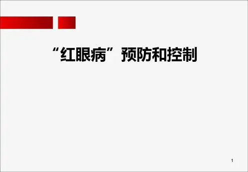 红眼病预防和控制知识PPT课件