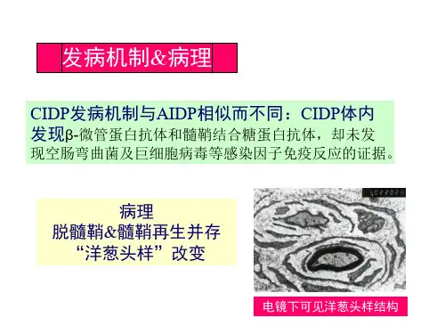 最新慢性炎症性脱髓鞘性多发性神经病课件-PPT文档