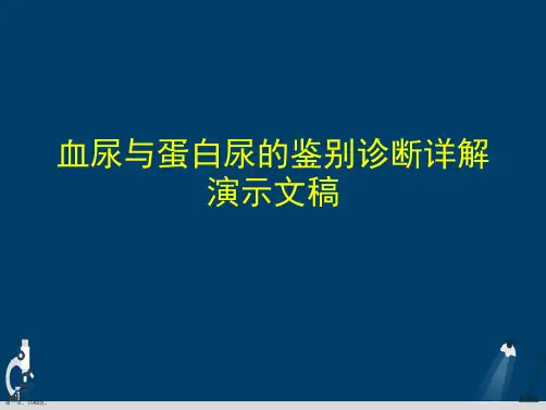 血尿与蛋白尿的鉴别诊断详解演示文稿