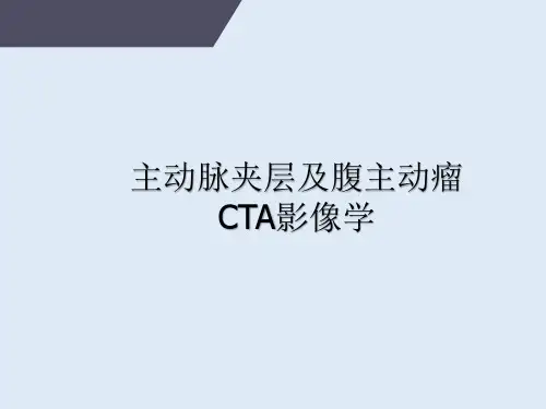 主动脉夹层及腹主动脉瘤CTA影像