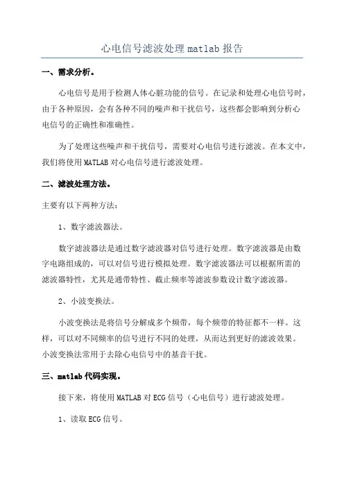 心电信号滤波处理matlab报告