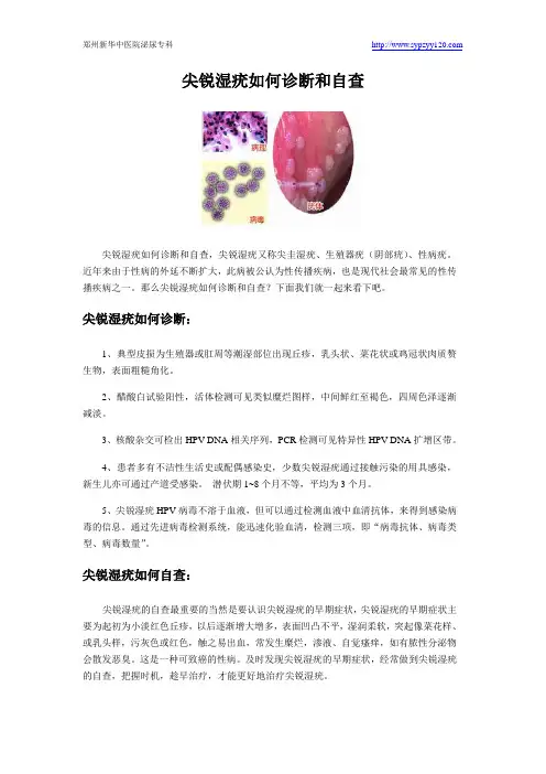 尖锐湿疣如何诊断和自查