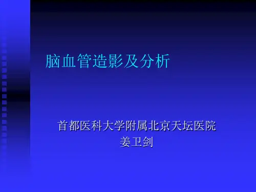 脑血管造影及分析