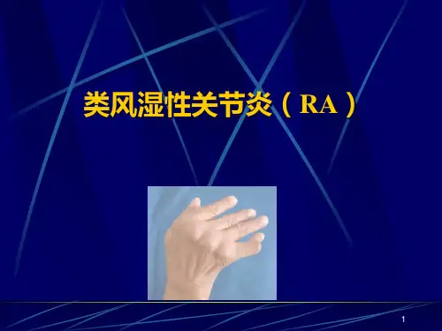类风湿性关节炎本科教学PPT课件