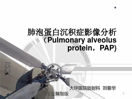 肺泡蛋白沉积症[专业知识]